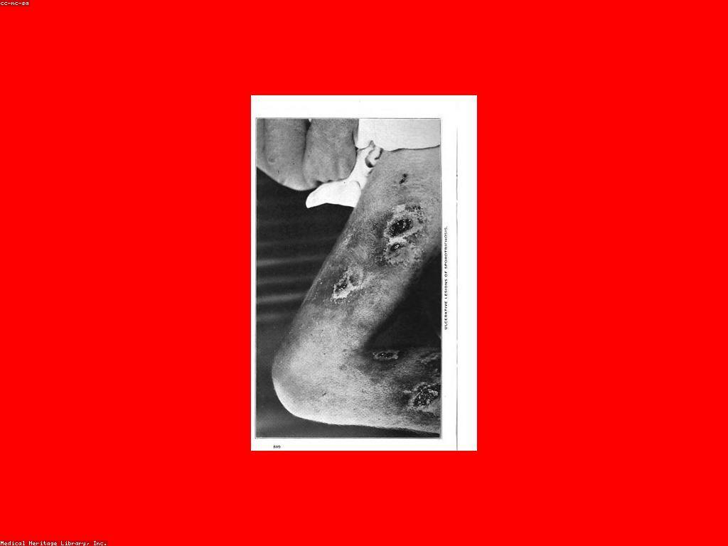 ប្រវត្តិ និងការប្រែប្រួលនៃកីឡាបាល់ទាត់